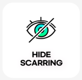 HIDE SCARRING: харагдахгүй сорви
