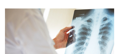 X-Ray шинжилгээ